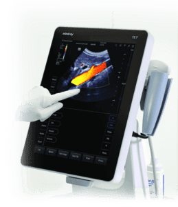 mobile ultrasound pacs image