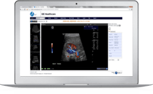 cloud medical imaging software on laptop