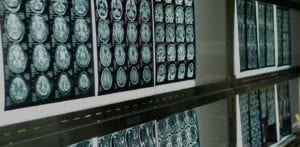 printed medical images on display