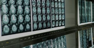 medical images printed out on display